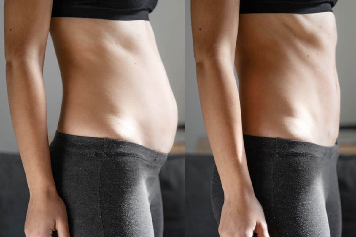 Post-Pregnancy: What Happens to Your Abdominal Muscles After Birth King's Heath