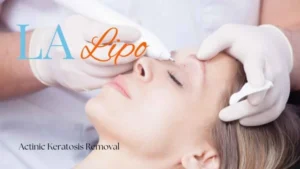 Woman receiving Actinic Keratosis Removal Treatment King's Heath