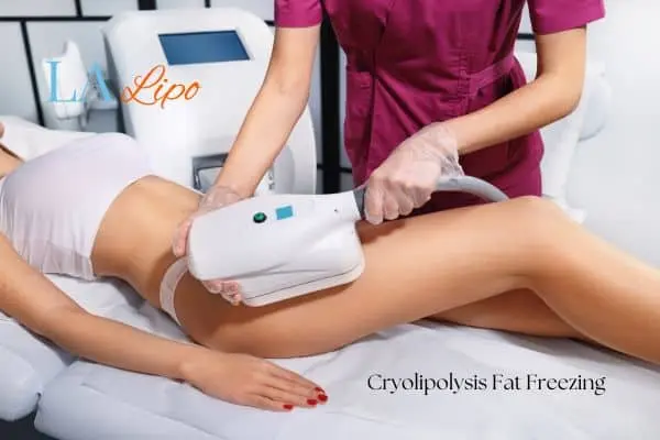 Woman receiving coolsculpting King's Heath treatment on her thighs