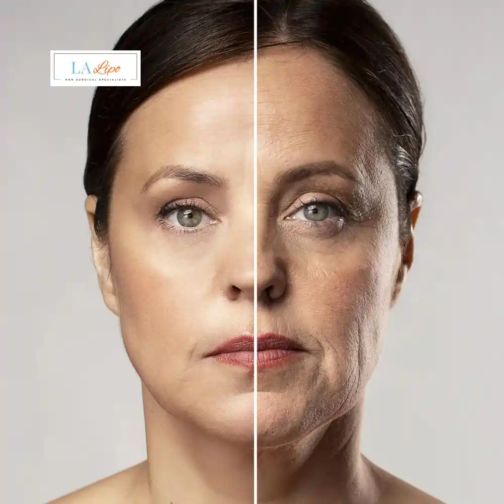 How Can You Tell If Non-Surgical Skin Tightening Is Right for You King's Heath?