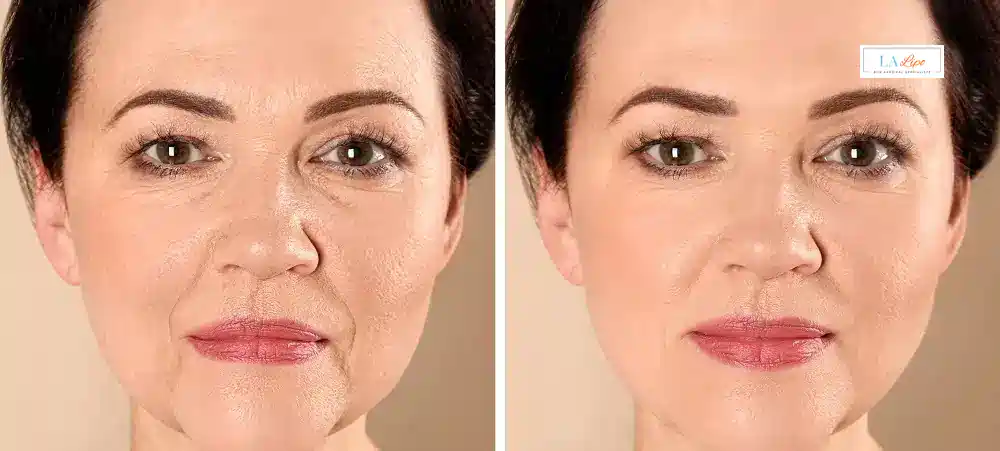 How Long Does It Take to See Results and How Long Do They Last King's Heath?