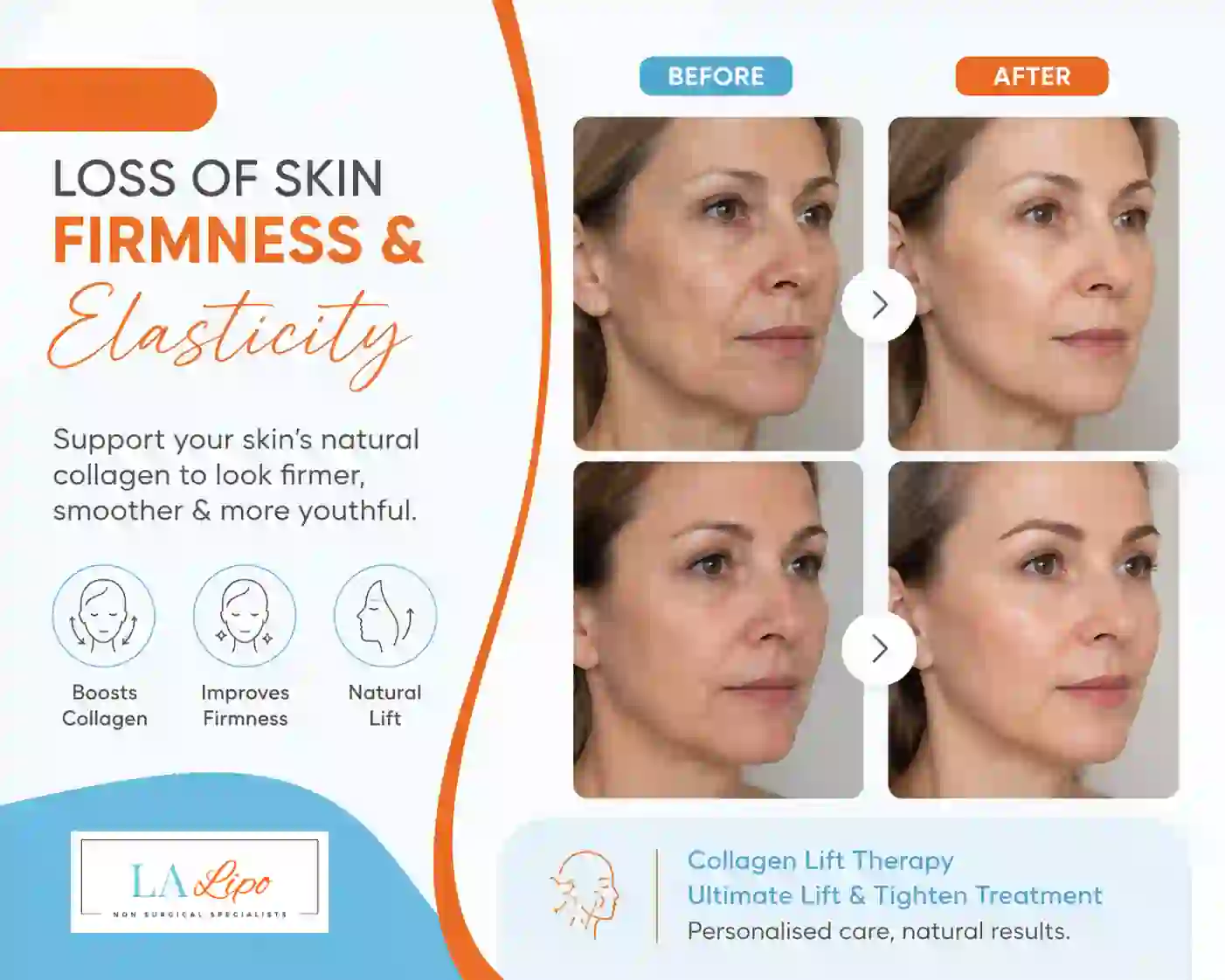 Sign #7: Loss of Skin Firmness and Elasticity King's Heath