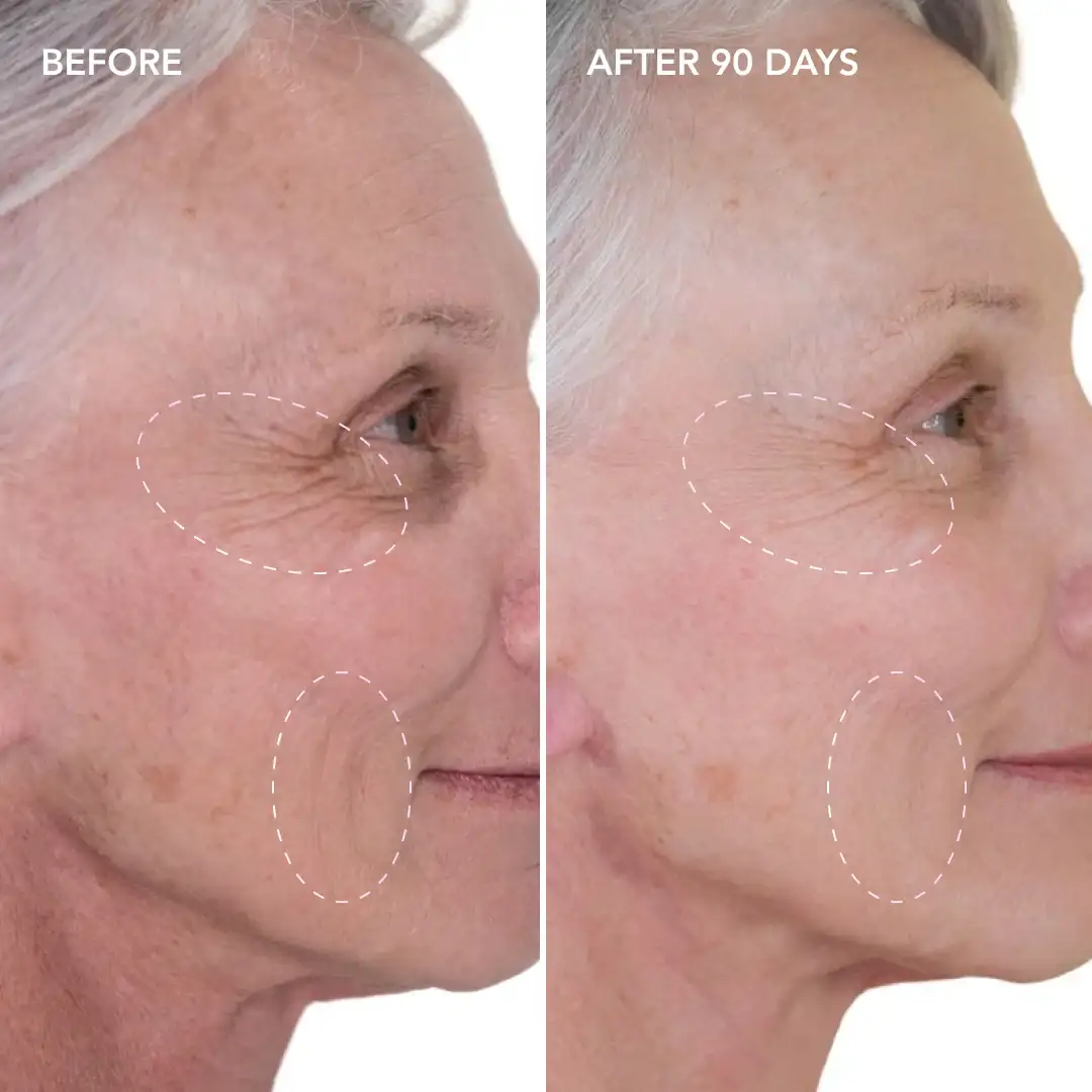 When will you see results King's Heath